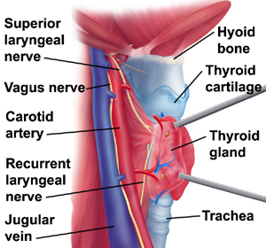 Laryngectomie - Hoofd Hals Centrum AVL vocal folds diagram 